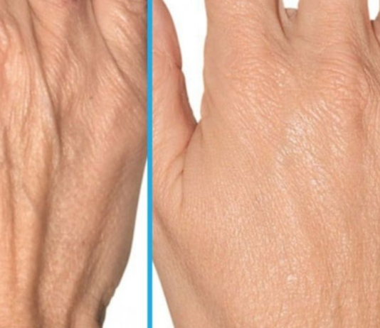 ნატურალური რეცეპტები ხელის კანისთვის. დაუბრუნეთ თქვენს კანს ახალგაზრდობა