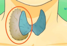 ექიმები ამას გვიმალავენ: ისწავლეთ ფარისებრი ჯირკვლის პრობლემების სწორად მკურნალობა!