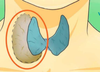 ექიმები ამას გვიმალავენ: ისწავლეთ ფარისებრი ჯირკვლის პრობლემების სწორად მკურნალობა!