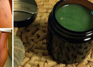 დედამ განკურნა ვარიკოზული ვენები ბებიისგან დარჩენილი ამ მარტივი რეცეპტით