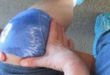 მუხლის ტკივილის დროს იგი ამ ზეთს იყენებდა ტკივილის შესამსუბუქებლად. ეს საოცარი ხრიკი ასევე დაგეხმარებათ..