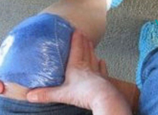 მუხლის ტკივილის დროს იგი ამ ზეთს იყენებდა ტკივილის შესამსუბუქებლად. ეს საოცარი ხრიკი ასევე დაგეხმარებათ..