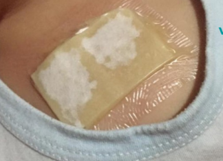 ჯანჯაფილის-თაფლის კომპრესი – მკურნალობს ძლიერ ხველას და აშორებს ლორწოს ფილტვებიდან მხოლოდ ერთ ღამეში!