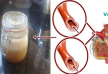 დაემშვიდობეთ მაღალ წნევას, ქოლესტერინს და ტრიგლიცერიდებს ამ ძლიერი სასმელით. .