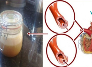 დაემშვიდობეთ მაღალ წნევას, ქოლესტერინს და ტრიგლიცერიდებს ამ ძლიერი სასმელით. .