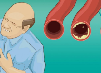 ეს საკვები გაგიხსნით არტერიებს და დაგიცავთ გულის შეტევისგან. მიირთვით მეტი მათგანი – იცოცხლეთ უფრო დიდხანს