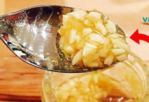 Ნიორი, ვაშლის ძმარი და თაფლი – მათი ბუნებრივი კომბინაცია შეიძლება გაუმკლავდეს დიაბეტს, ჭარბ წონას, დისპეფსიას და სხვა დაავადებებს!