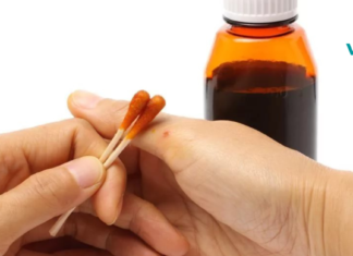 აი, რატომაა სასარგებლო ღამით ქუსლებზე იოდის ბადის დახატვა. მარტივი და ეფექტური სამკურნალო მეთოდი. .