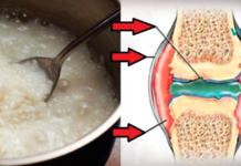 სახსრების ტკივილი წარსულში დარჩა! ბრინჯი ამ საკითხშიც ეფექტურად დაგეხმარებათ, გაეცანით რეცეპტს. .