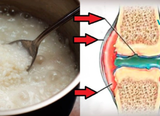 სახსრების ტკივილი წარსულში დარჩა! ბრინჯი ამ საკითხშიც ეფექტურად დაგეხმარებათ, გაეცანით რეცეპტს. .