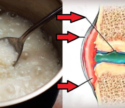 სახსრების ტკივილი წარსულში დარჩა! ბრინჯი ამ საკითხშიც ეფექტურად დაგეხმარებათ, გაეცანით რეცეპტს. .