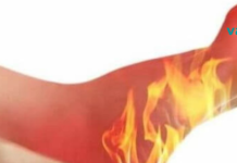 გაწუხებთ ფეხებში წვის შეგრძნება? ჩვენ გასწავლით ეფექტურ მეთოდს ამ პრობლემისგან თავის დასაღწევად!