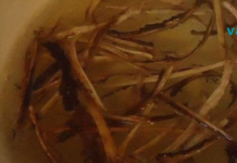 ფისტულისა და ოსტეომიელიტის უებარი სამკურნალო რეცეპტი, რომელიც მზადდება სახლის პირობებში!