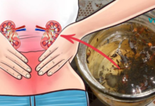 100% შედეგი გარანტირებულია: ეს ნახარშები თირკმელებს კენჭებისგან და ნადებისგან სამუდამოდ გაწმენდს