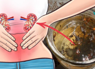 100% შედეგი გარანტირებულია: ეს ნახარშები თირკმელებს კენჭებისგან და ნადებისგან სამუდამოდ გაწმენდს