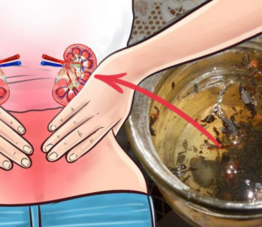 100% შედეგი გარანტირებულია: ეს ნახარშები თირკმელებს კენჭებისგან და ნადებისგან სამუდამოდ გაწმენდს