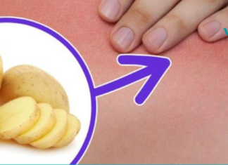 თუ დაგიგროვდათ მარილები კისრის არეში, მაშინ მას უმკურნალეთ ამ მეთოდით. .