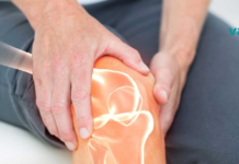 ამ ქალს არ შეეძლო ლოგინიდან ადგომა სახსრების ძლიერი ტკივილისდა გამო, სანამ ამის მიღება არ დაიწყო.