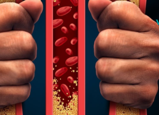 როგორ მოვიშოროთ ქოლესტერინი სახლის პირობებში?