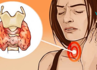 მეგობრებო იცოდით თუ არა, რა იწვევს ფარისებრი ჯირკვლის გადიდებას და როგორ ავირიდოთ თავიდან ეს დაავადება ?! ჩვენ მოგახსენებთ ამის შესახებ. .