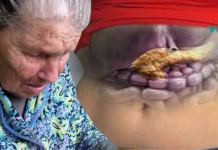 სასწრაფოდ! უებარი რეცეპტი ბებოსგან, რომელის გამოყენების შემდეგ კუჭქვეშა ჯირკვლისგან გათავისუფლდებით. .