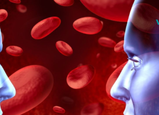 ანემიის სიმპტომები და 5 საუკეთესო საშინაო მეთოდი მის სამკურნალოდ!