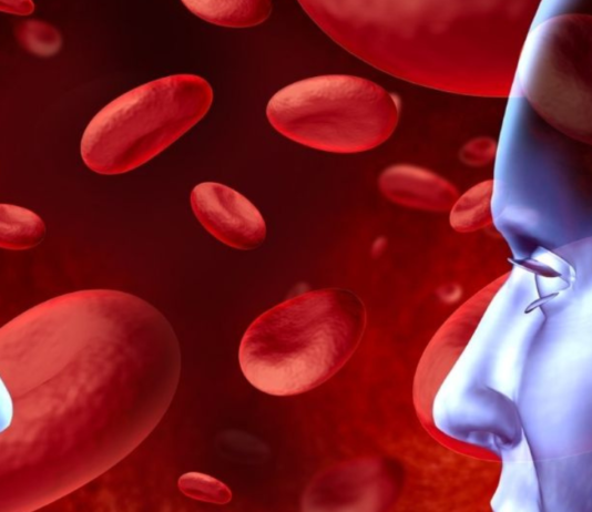 ანემიის სიმპტომები და 5 საუკეთესო საშინაო მეთოდი მის სამკურნალოდ!