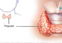 ამას ვერასდროს გაიგებთ თქვენი ექიმისგან: როგორ განკურნოთ ფარისებრი ჯირკვალი მხოლოდ ორი ინგრედიენტით!