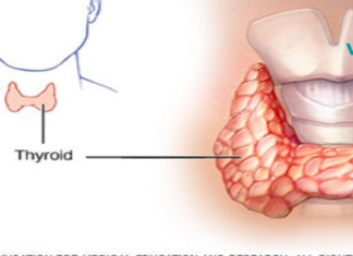 ამას ვერასდროს გაიგებთ თქვენი ექიმისგან: როგორ განკურნოთ ფარისებრი ჯირკვალი მხოლოდ ორი ინგრედიენტით!