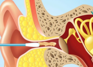ექიმები ხალხს ევედრებიან, რომ ბამბის ჩხირები არ გამოიყენონ! მიზეზი შეიძლება გაგიკვირდეთ…