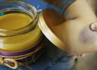 საშუალება, რომელიც ძალიან სწრაფად მოგაშორებთ სილურჯეებს! საუბარი გვაქვს სალბისა და თაფლის მალამოს შესახებ. .