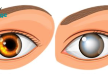 ექიმებმა აღმოაჩინეს რა არის სიბრმავის ერთ-ერთი მთავარი მიზეზი! ახლაც შოკირებული ვარ. .