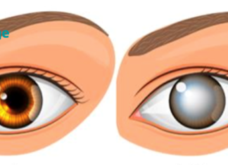 ექიმებმა აღმოაჩინეს რა არის სიბრმავის ერთ-ერთი მთავარი მიზეზი! ახლაც შოკირებული ვარ. .