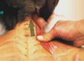 როგორ მოვიშოროთ ზურგისა და კისრის ტკივილი ყოველგვარი ტკივილგამაყუჩებელი წამლების გარეშე!