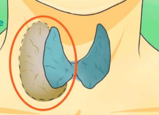 ექიმებმა ეს დაგვიმალეს! : ისწავლეთ ფარისებრი ჯირკვლის პრობლემების სწორად მკურნალობა!