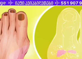 3 მკვეთრი ნიშანი, რომელიც ართრიტზე მიუთითებს. რა უნდა გააკეთოთ მისი პრევენციისთვის, გაიგეთ აქ…