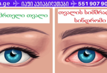 ეს მეთოდი აუმჯობესებს დაბინდულ მხედველობას და ხსნის თვალის წვას მარტივი სახლის რეცეპტით!
