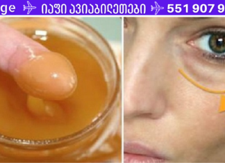 გპირდებით: წაისვით ეს ნაზავი თვალების ქვეშ მუქ წრეებზე და დილით მათ გარეშე გაიღვიძებთ!