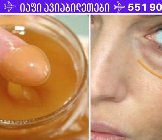 გპირდებით: წაისვით ეს ნაზავი თვალების ქვეშ მუქ წრეებზე და დილით მათ გარეშე გაიღვიძებთ!