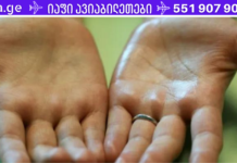 ღამით ოფლიანობა შესაძლოა საკმაოდ სერიოზული პრობლემის მიზეზი იყოს – თუ ეს პრობლემა გაწუხებთ, სასწრაფოდ მიმართეთ ექიმს!