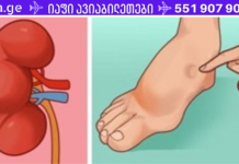 ინსულტამდე ერთი თვით ადრე თქვენი სხეული გიგზავნით ამ გამაფრთხილებელ ნიშნებს – ნუ უგულებელყოფთ მათ!