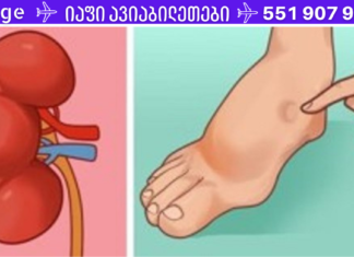 ინსულტამდე ერთი თვით ადრე თქვენი სხეული გიგზავნით ამ გამაფრთხილებელ ნიშნებს – ნუ უგულებელყოფთ მათ!