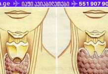 აურიეთ თითო ჭიქა წიწიბურა, ნიგოზი, თაფლი და რაღაც განსაკუთრებული დაემართება თქვენს ორგანიზმს!