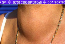 ეს პოპულარული სასმელი ანადგურებს ფარისებრ ჯირკვალს. რამდენად ხშირად სვამთ მას. .?