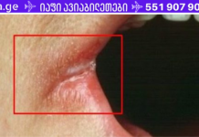 ფრთხილად! გქონიათ თუ არა ამ სიმპტომებიდან ერთ-ერთი? ნუ უგულებელყოფთ მათ, რადგან ისინი ჯანმრთელობის პრობლემებზე მიგვანიშნებენ!