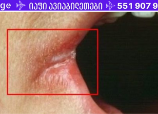 ფრთხილად! გქონიათ თუ არა ამ სიმპტომებიდან ერთ-ერთი? ნუ უგულებელყოფთ მათ, რადგან ისინი ჯანმრთელობის პრობლემებზე მიგვანიშნებენ!