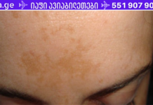 ამ საკვების რეცეპტით, რომელიც შეიცავს მხოლოდ 2 ინგრედიენტს მოიშორეთ ლაქები, ნაოჭები და ჰიპერპიგმენტაცია !