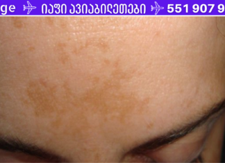 ამ საკვების რეცეპტით, რომელიც შეიცავს მხოლოდ 2 ინგრედიენტს მოიშორეთ ლაქები, ნაოჭები და ჰიპერპიგმენტაცია !