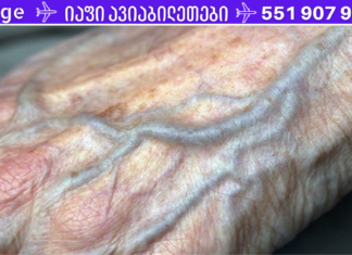 გაწუხებთ ცუდი სისხლის მიმოქცევა და ცივი კიდურები? აი, რისი გაკეთება შეგიძლიათ ამ პრობლემის მოსაგვარებლად!