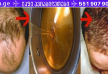 მკურნალობა გამელოტების წინააღმდეგ. საოცარი რეცეპტი: 2 დღის შემდეგ თქვენი თმა დაიწყებს ზრდას!